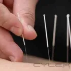 Business 1 image ACUPUNCTURE SUPPLY CO Medical Equipment & Supplies in Dublin D