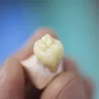 Business 9 image CROWN DENTAL DUBLIN Dentists in Dublin D