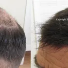 Business 7 image JK HAIR REPLACEMENT Wigs & Hairpieces in Dublin IE


