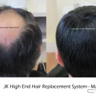 Business 10 image JK HAIR REPLACEMENT Wigs & Hairpieces in Dublin IE



