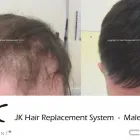 Business 11 image JK HAIR REPLACEMENT Wigs & Hairpieces in Dublin IE


