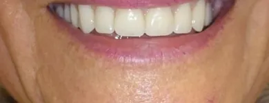 Business 1 image CAVAN DENTURE CLINIC Health & Medicine in Cavan IE


