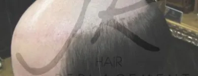 Business 2 image JK HAIR REPLACEMENT Wigs & Hairpieces in Dublin IE


