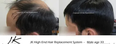 Business 9 image JK HAIR REPLACEMENT Wigs & Hairpieces in Dublin IE


